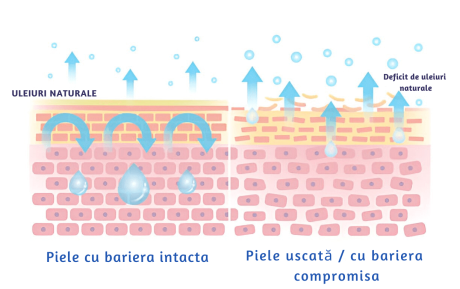 Comparatie intre pielea cu bariera intacta si pielea uscata cu bariera compromisa