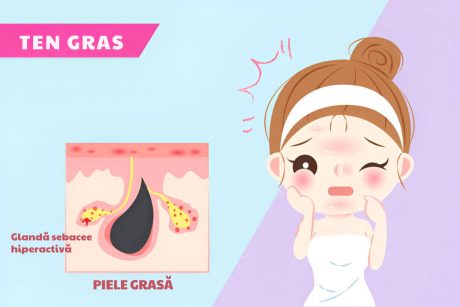 ilustratie cu pielea grasa si glandele sebacee hiperactive