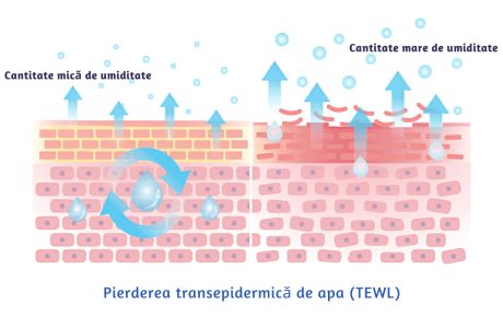 Pierderea transepidermica de apa la nivelul pielii (TEWL)